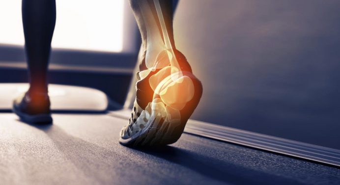 Have You Ever Thought Why Your Feet Burns During A Run?